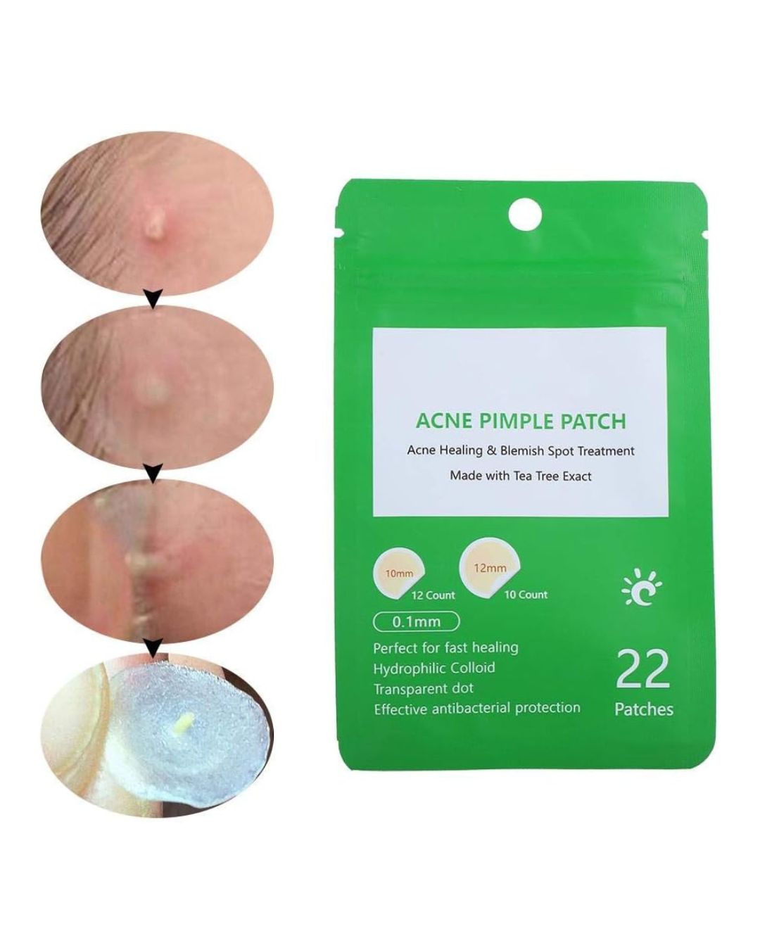 Acne Pimple Patch