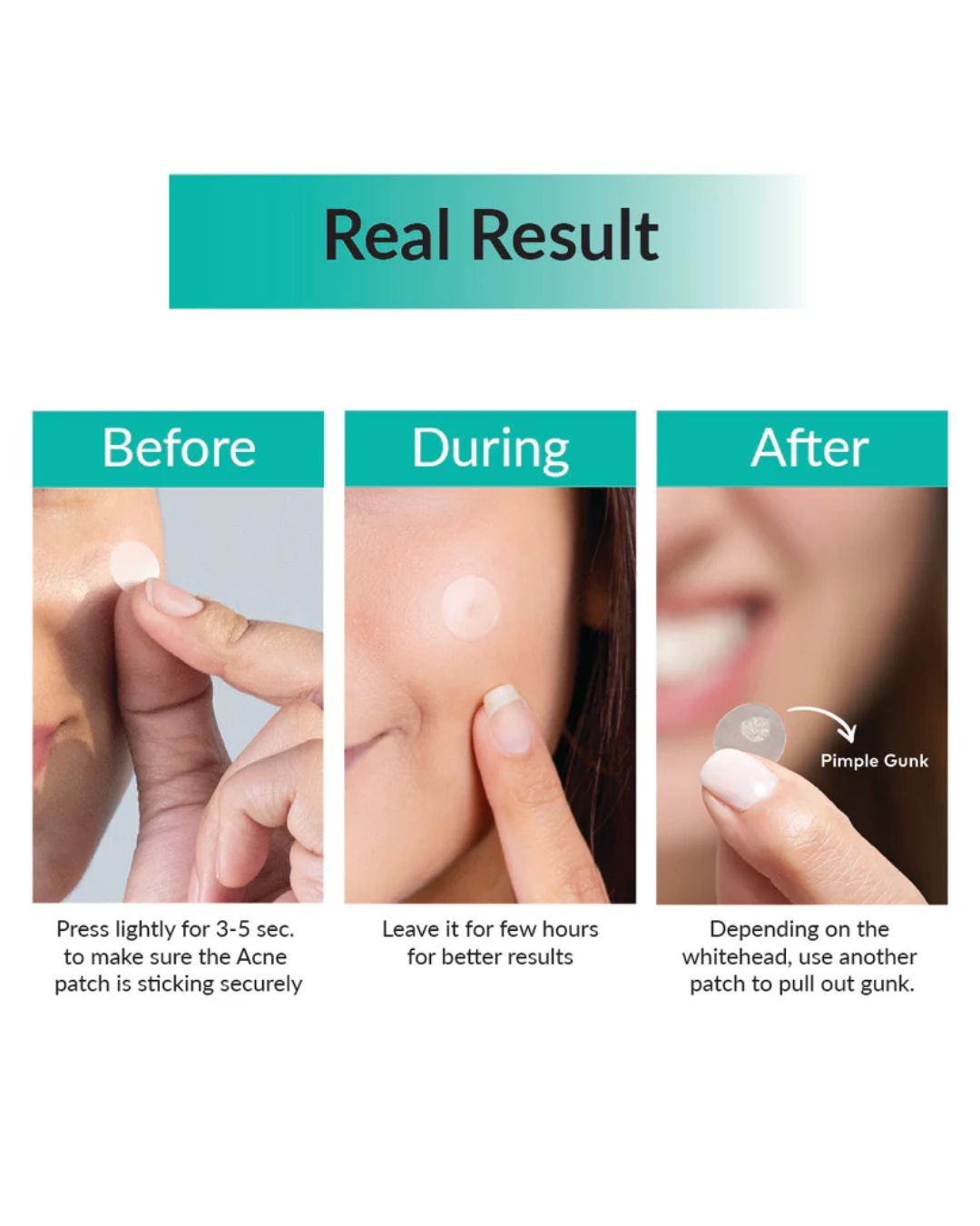 Acne Pimple Patch