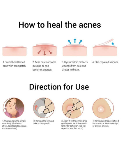 Acne Pimple Patch