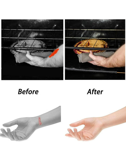 Silicone Oven Burn Protection Strips