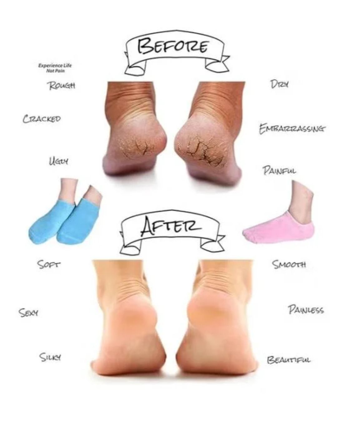 Moisturizing Gel Socks