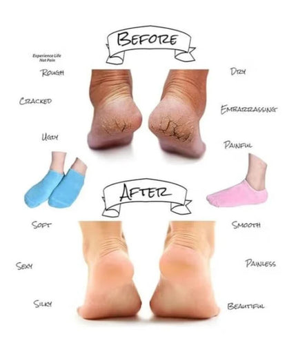 Moisturizing Gel Socks